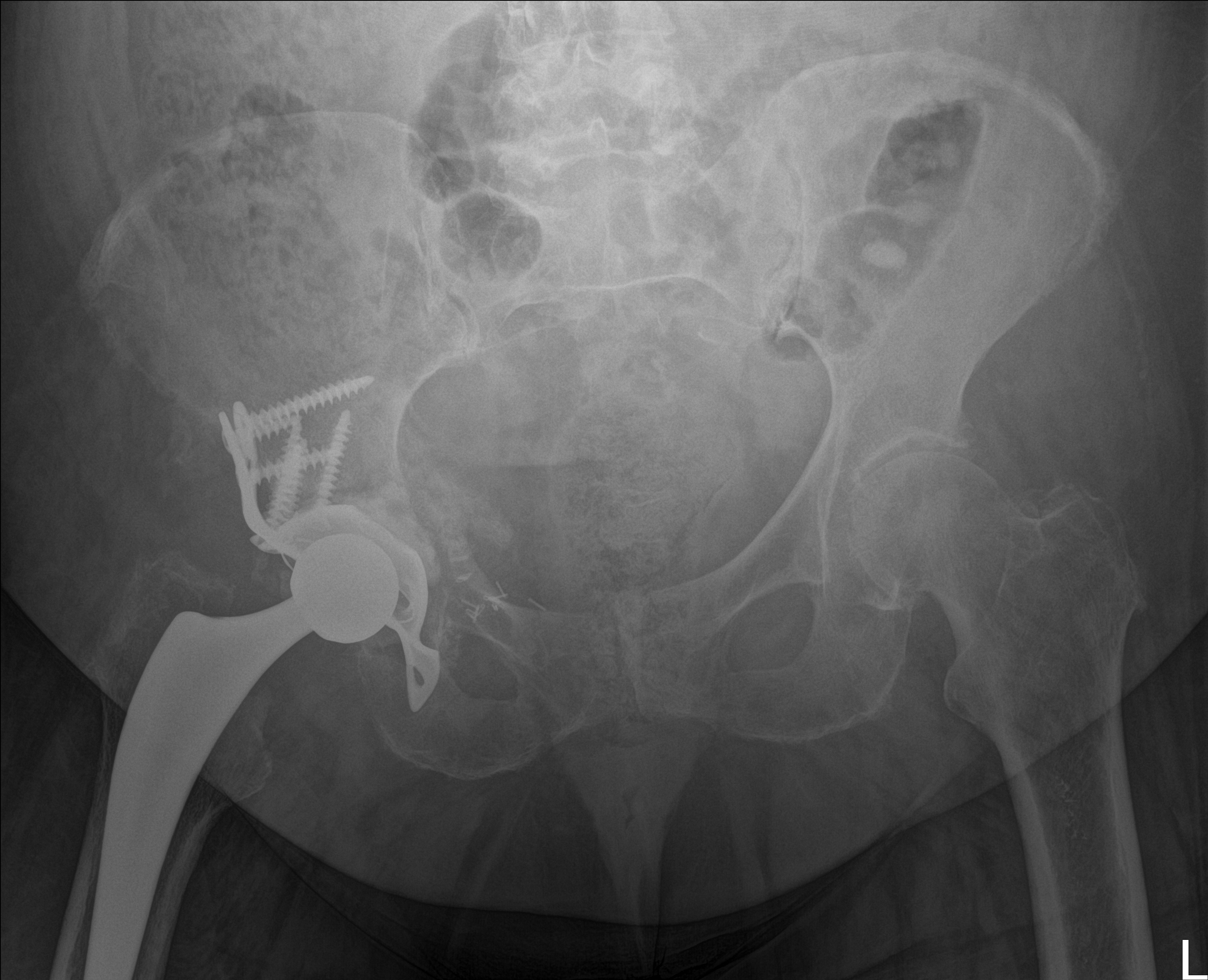 Röntgen Oktober 2024