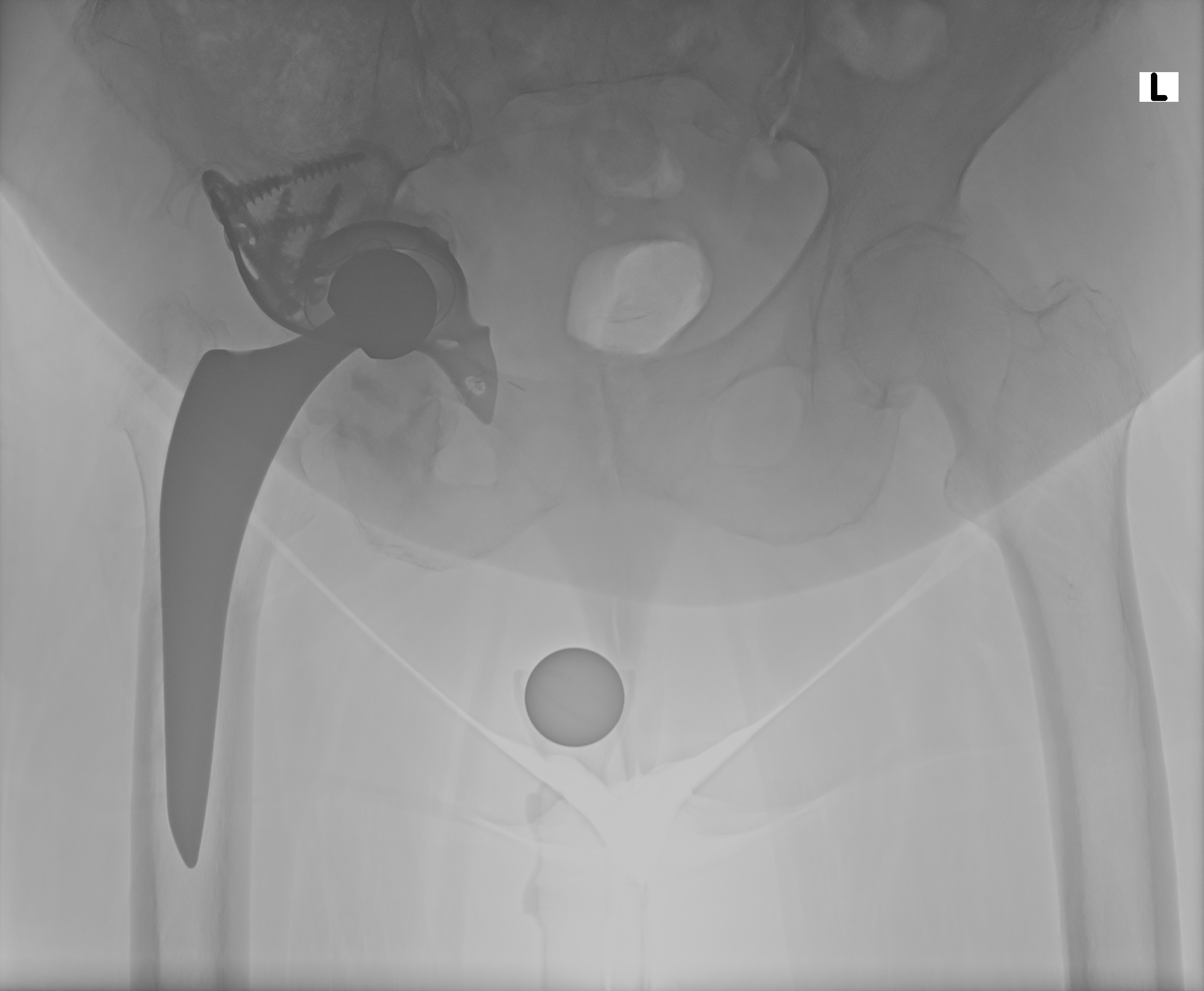 Röntgen November 2025